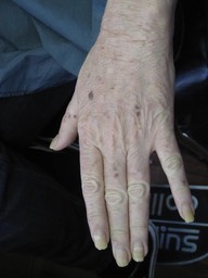 2. old ageed hand